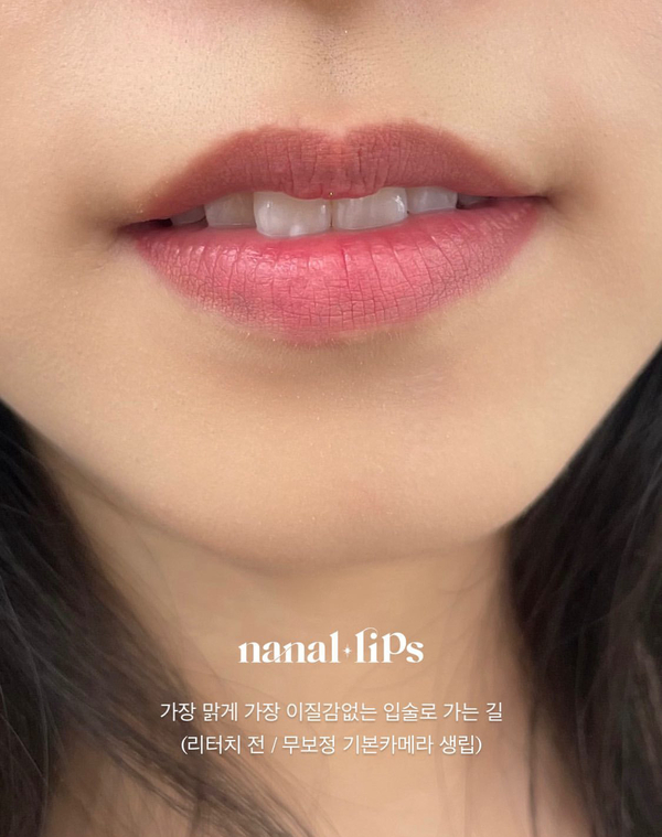  서울강남 어두운검은 입술색소침착 무통증 입술문신 유명한곳