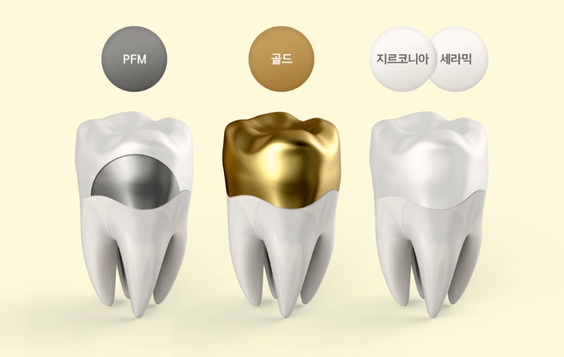 %ED%81%AC%EB%9D%BC%EC%9A%B47