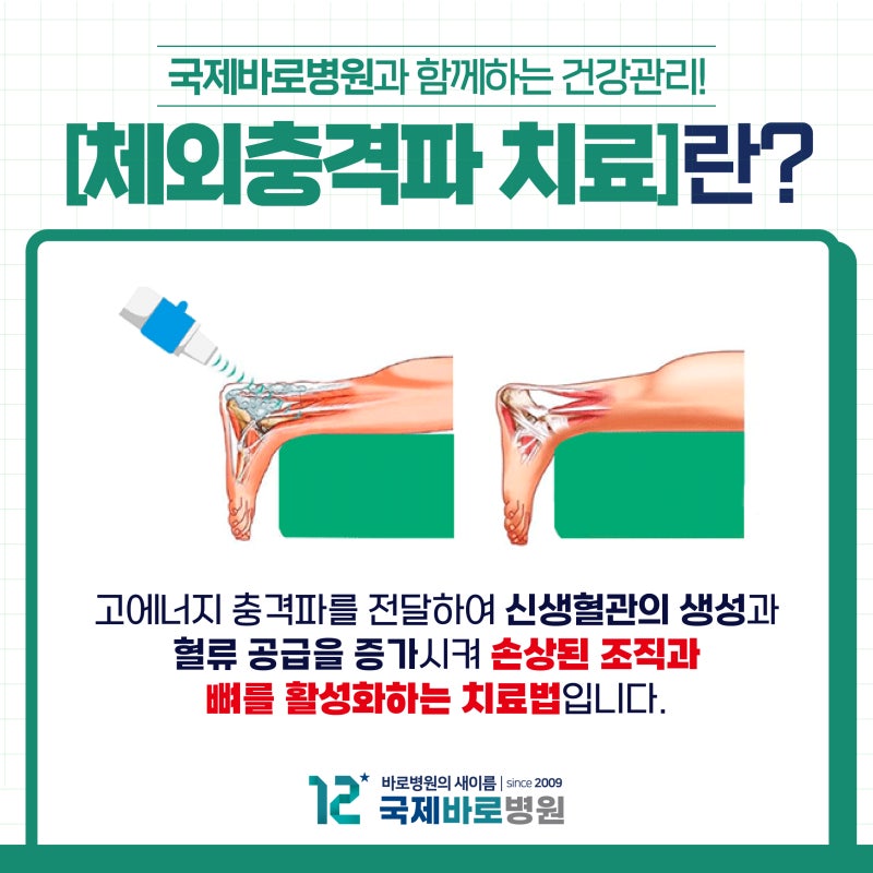 인천체외충격파치료는 국제바로병원