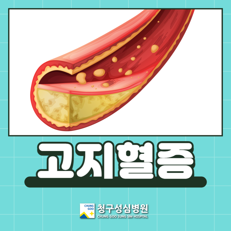 연신내 내과 / 고지혈증 고지혈증 예방과 관리방법