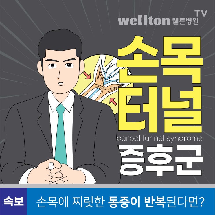  마곡나루역병원, 손목에 찌릿한 통증이 터널증후군 증상?