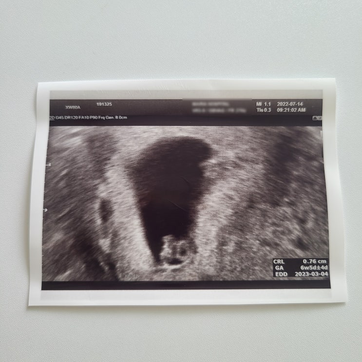 임신초기 일란성쌍둥이 6~7주 입덧 증상들과 무기력함