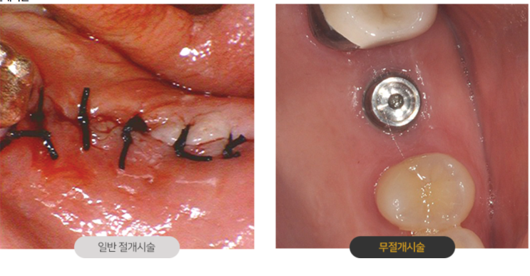 구산역치과 <치아와 수명과의 관계는?>