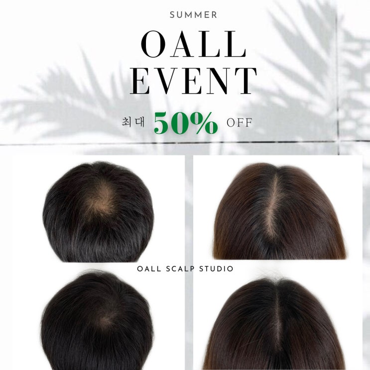  [OALL Scalp studio] SMP 가격 여름 할인 이벤트!
