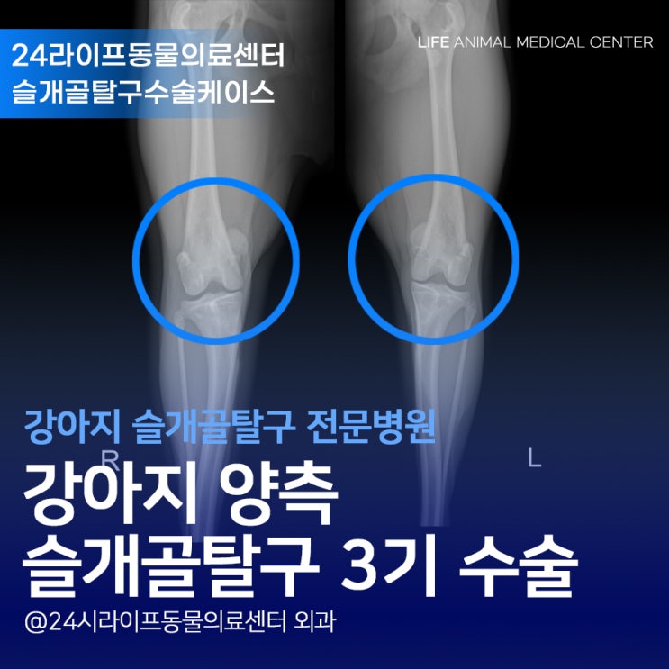 대구 강아지 슬개골탈구전문병원 : 9kg 강아지 양측 슬개골탈구 3기 수술