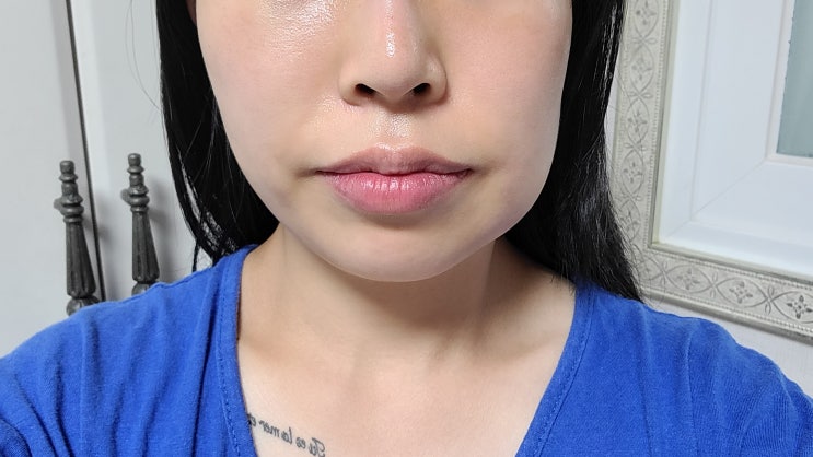  7월3주 주간일기 : 사랑니 재발치 및 치아교정 발치