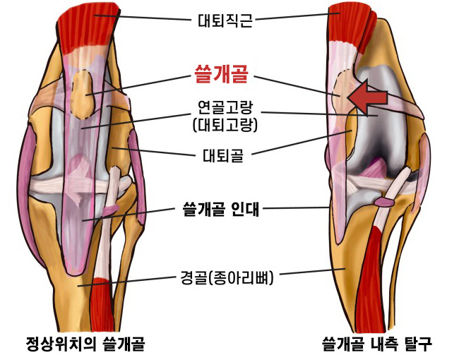  강아지 쓸개골 탈구 증상과 예방