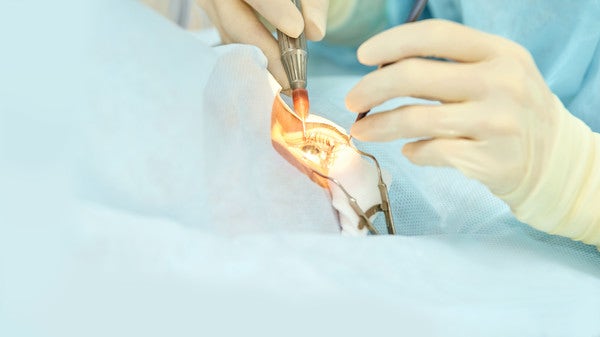 "과잉 진료 vs 필요 치료" 백내장 실손보험 미지급 사태 '갑론을박' "과잉 진료 vs 필요 치료" 백내장 실손보험 미지급 사태 '갑론을박'