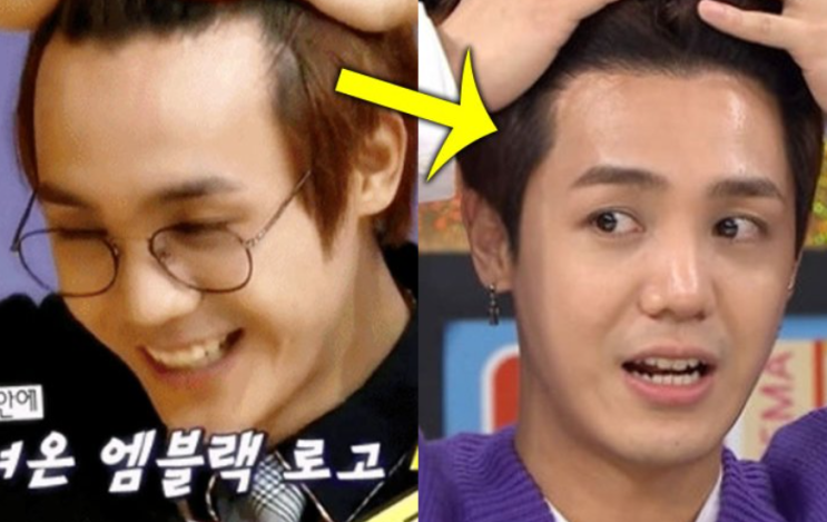  엠자탈모의 최고의 치료법, 모발이식이란