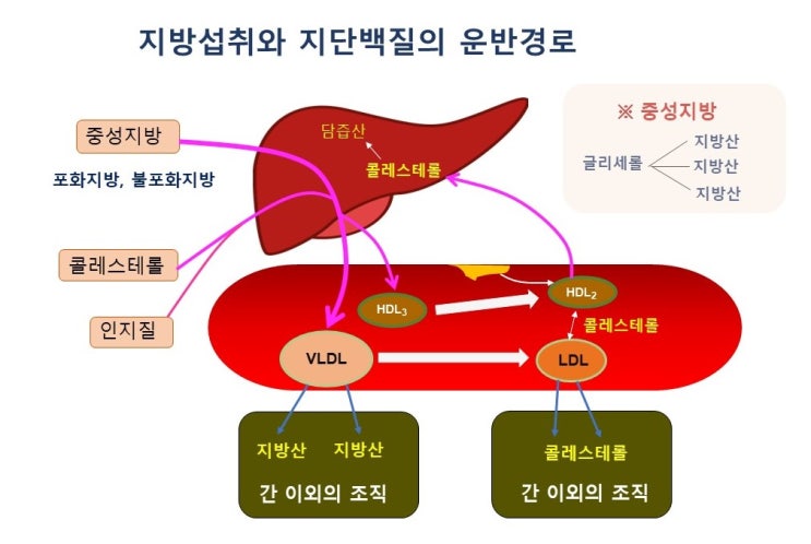 알콜성지방간, 비알콜성지방간 원인과 대처, 인슐린저항성, LDL콜레스테롤(저밀도지단백콜레스테롤)