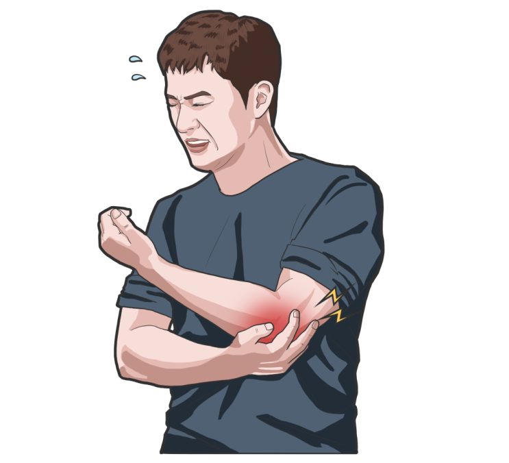 팔꿈치 통증의 주범, 테니스엘보와 골프엘보의 검사와 치료 팔꿈치 통증의 주범, 테니스엘보와 골프엘보의 검사와 치료