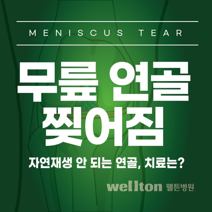  반월상연골손상 자연재생되지 않는 무릎연골 찢어짐 수술