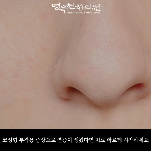 코성형 부작용 증상으로 염증이