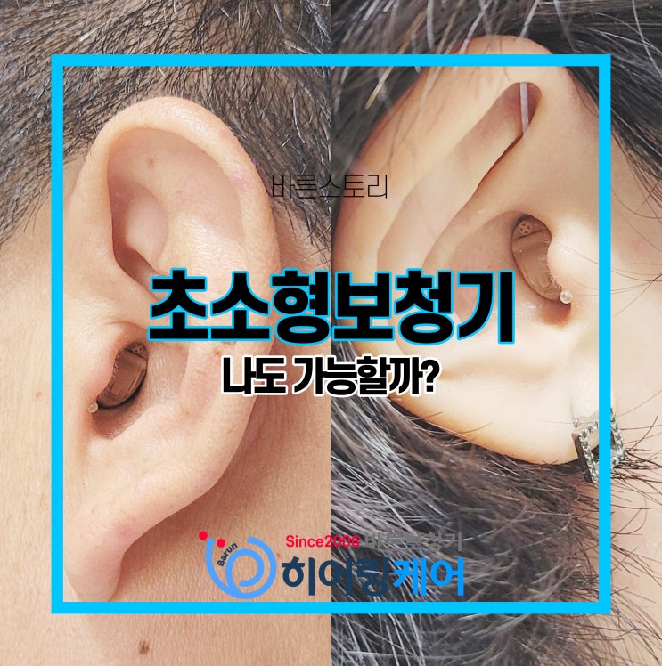  초소형 귓속형보청기 저도 가능한가요?