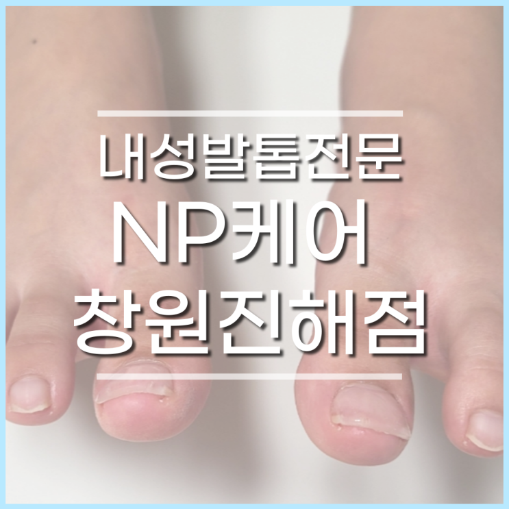  진해내성발톱 교정, 진해발톱무좀 전문, np케어 창원진해점