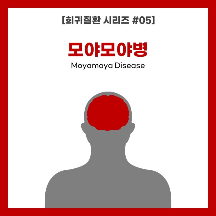  [희귀질환 시리즈 #05] 모야모야병