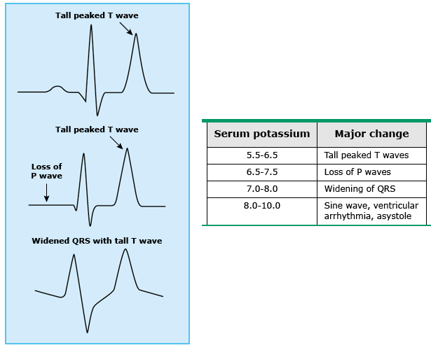  고칼륨혈증(hyperkalemia)의 증상, 원인과 치료방법은? calcium gluconate와 glucose insulin 치료법.