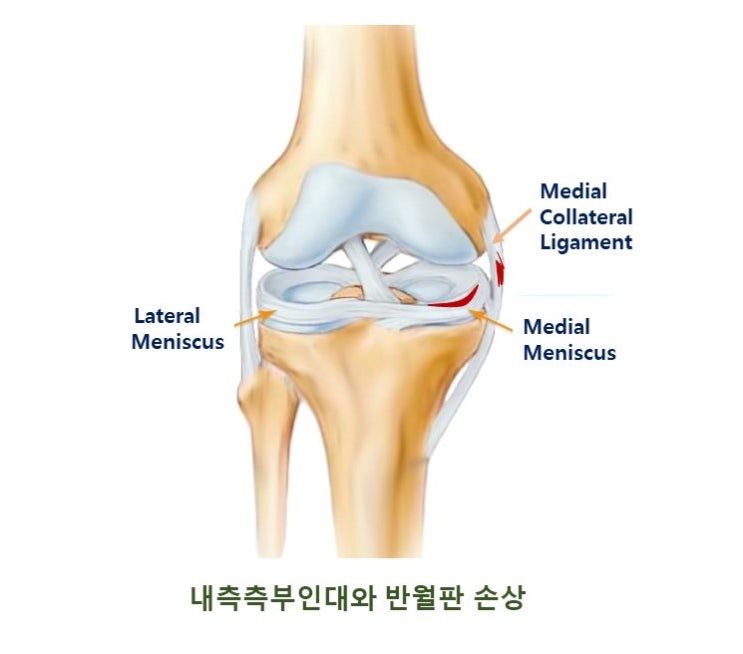  스포츠손상과 재활, 무릎통증, 인대와 연골손상, 무릎재활과 기능회복