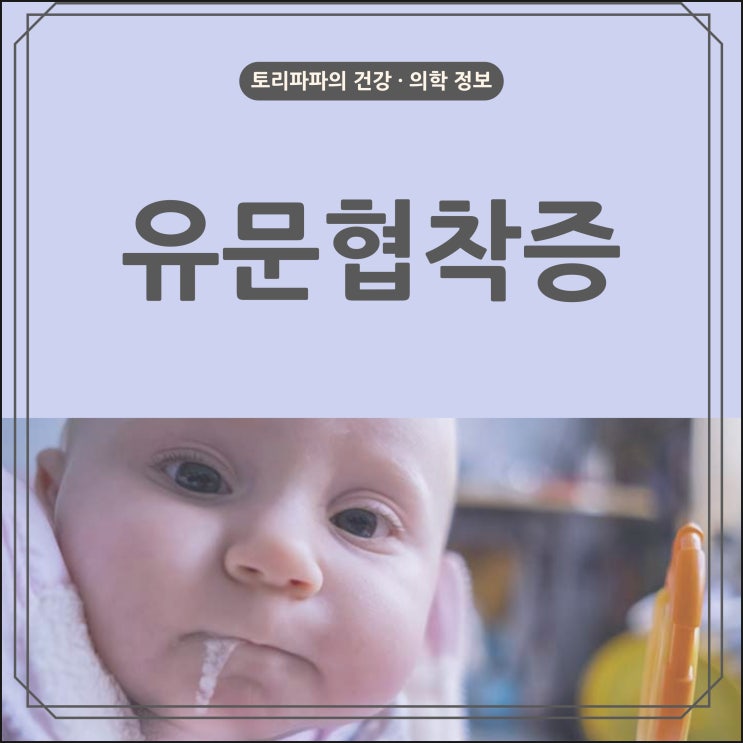  신생아 분수토 :  영아 비후성 유문 협착증