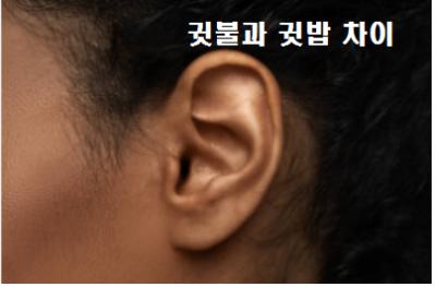  귓불과 귓밥 차이