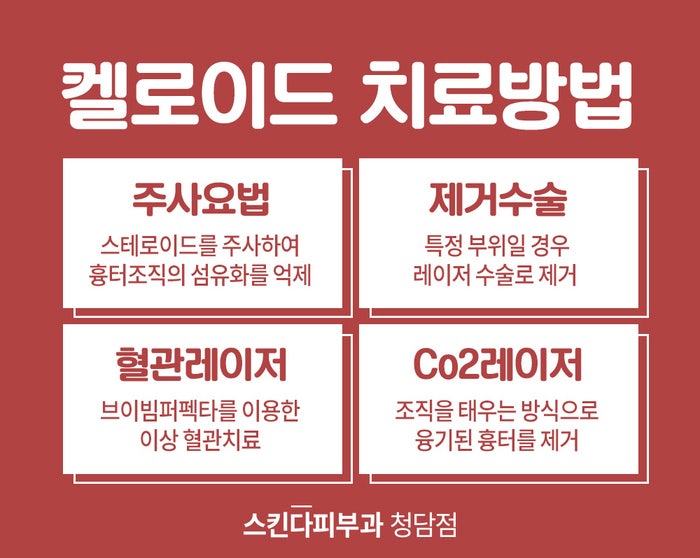 켈로이드 피부 주사, 레이저 및 수술의 차이점은 무엇입니까?