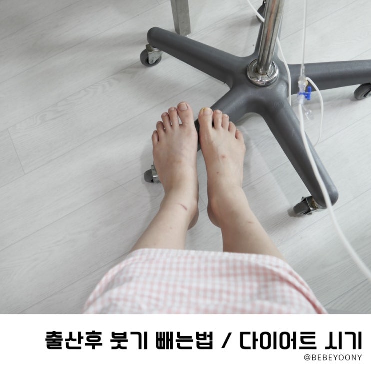  출산후 붓기 빼는법과 다이어트 시기는?