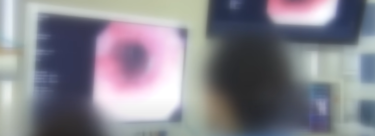 건강검진 받으러 간 40대, 수면 내시경 도중 심정지 사망 의료사고? 건강검진 받으러 간 40대, 수면 내시경 도중 심정지 사망 의료사고?