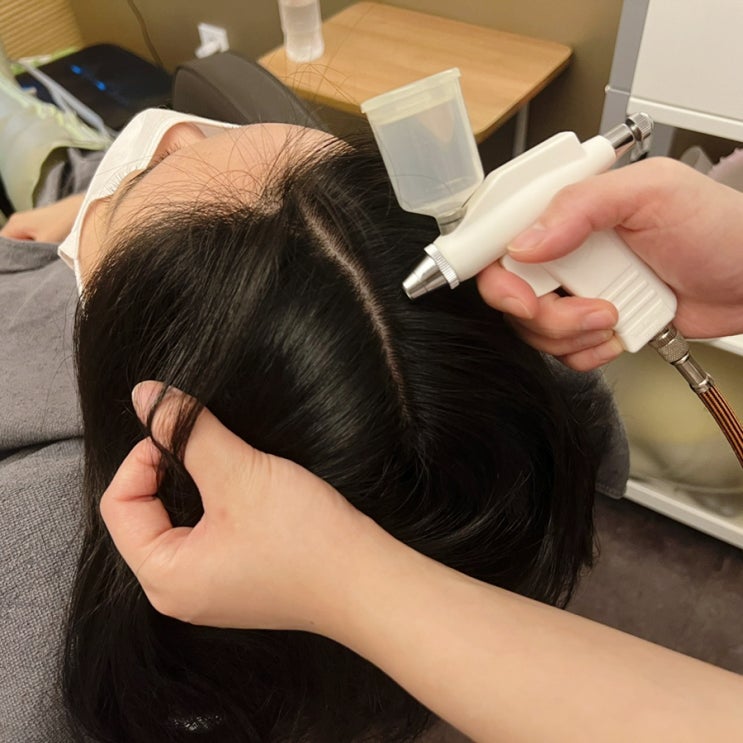  지루성두피염탈모 사당역두피케어 탑스칼프에서 관리받은 후기