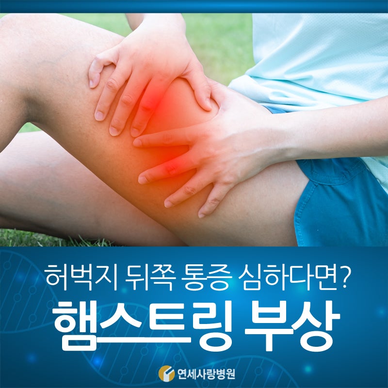 허벅지 뒤쪽 햄스트링의 고통스러운 파열에 주의 2