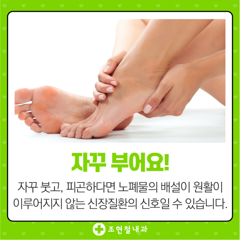크레아티닌 수치가 높으면 어떤 의미를 가질까요? 5