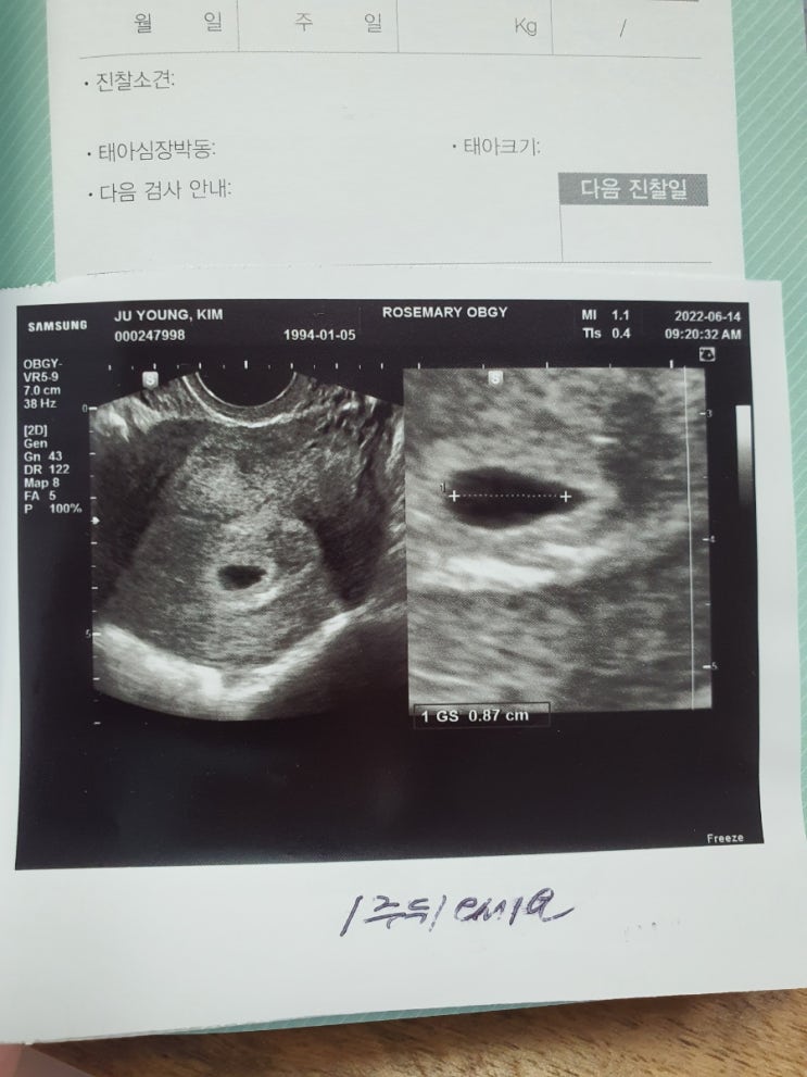 임신 4~6주차 일기 - 임신초기증상이 나타나는 시기는 생각보다 빨랐다