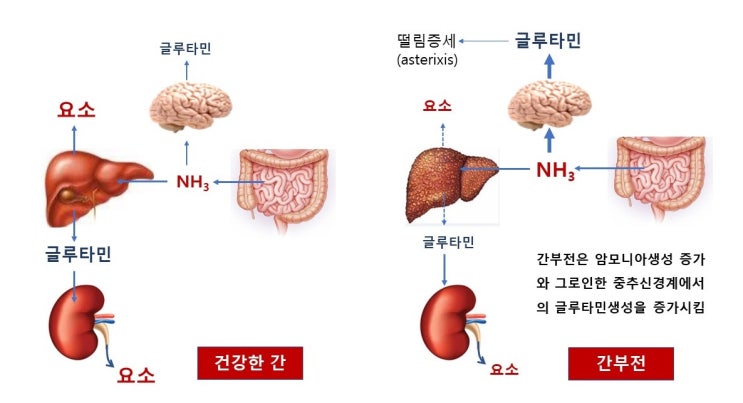  간질환, 침묵의 장기(Mr. Quiet), 요소회로와 간성혼수(간성뇌증), 알콜성, 비알콜성 지방간