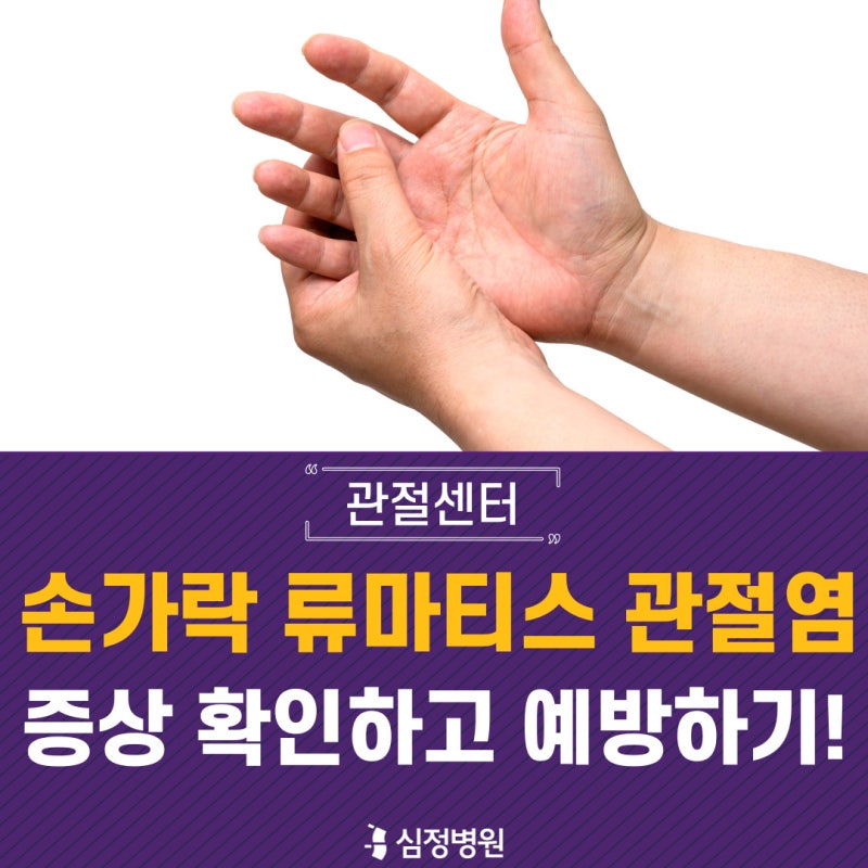 손가락마디통증, 류마티스관절염 치료 4