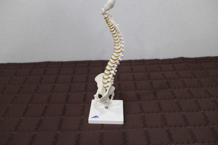  하부교차증후군의 원인, 증상, 진단, 한의원 치료