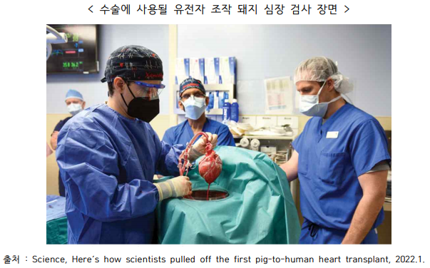  "한 걸음 더 가까워진 이종장기 이식"