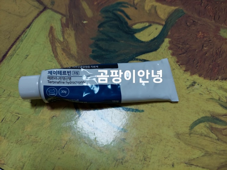  무좀 치료 제이테르빈 크림 - 무좀 치료 가이드 - 테르비나핀