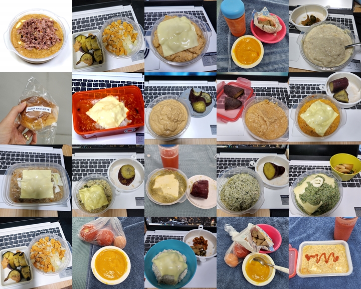  면목동 사가정 치과 매복사랑니 발치 비용, 통증, 식사기록부터 항생제 부작용 체중증가까지