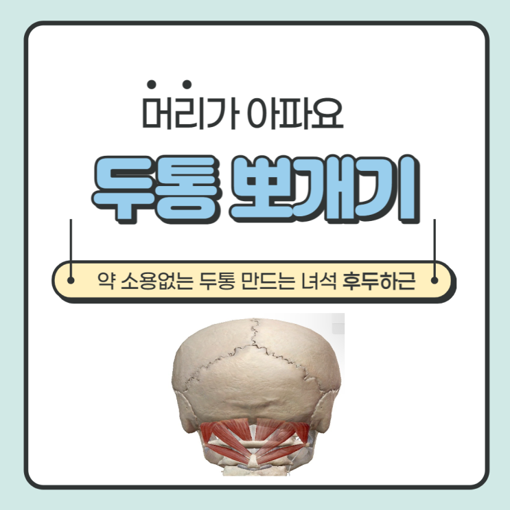  타이레놀 소용없는 두통을 만드는 녀석 후두하근 (상)
