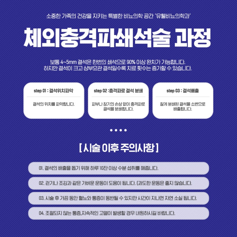 청주요로결석 재발이 빈번한 경우 내시경수술 가능한 곳