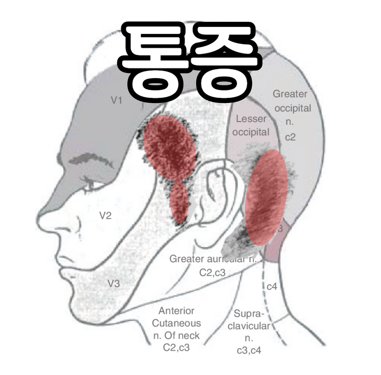 [대전 3차 신경통] 귀에서 아래턱까지 톡 쏘는 통증, 3차 신경통입니까?