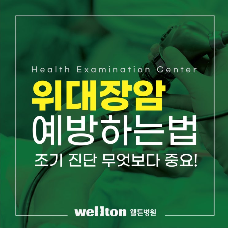  웰튼병원 내과전문의가 알려주는 위암 대장암 예방법