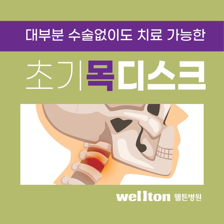  목디스크 비수술 치료 중요한건 시기!