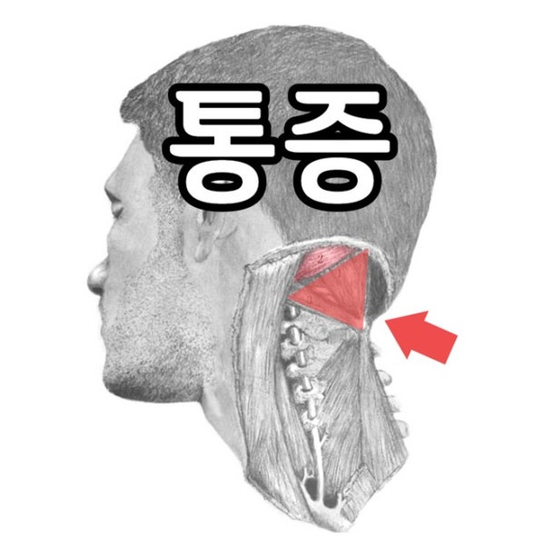 뒷목·뒷골이 땡기는 이유 통증 원인 증상 예방법 및 목지압기 소개