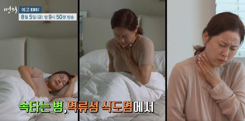 EBS명의, 역류성식도염, 식도암 명의 김도훈 교수 프로필 , 역류성식도염 원인 증상