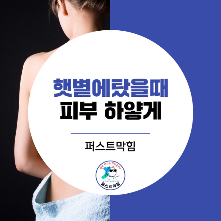  햇볕에탔을때, 검게탄피부 하얗게 만드는법은?