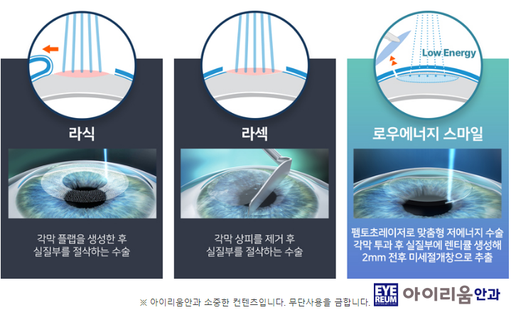 in order to improve the quality of military Smiler life