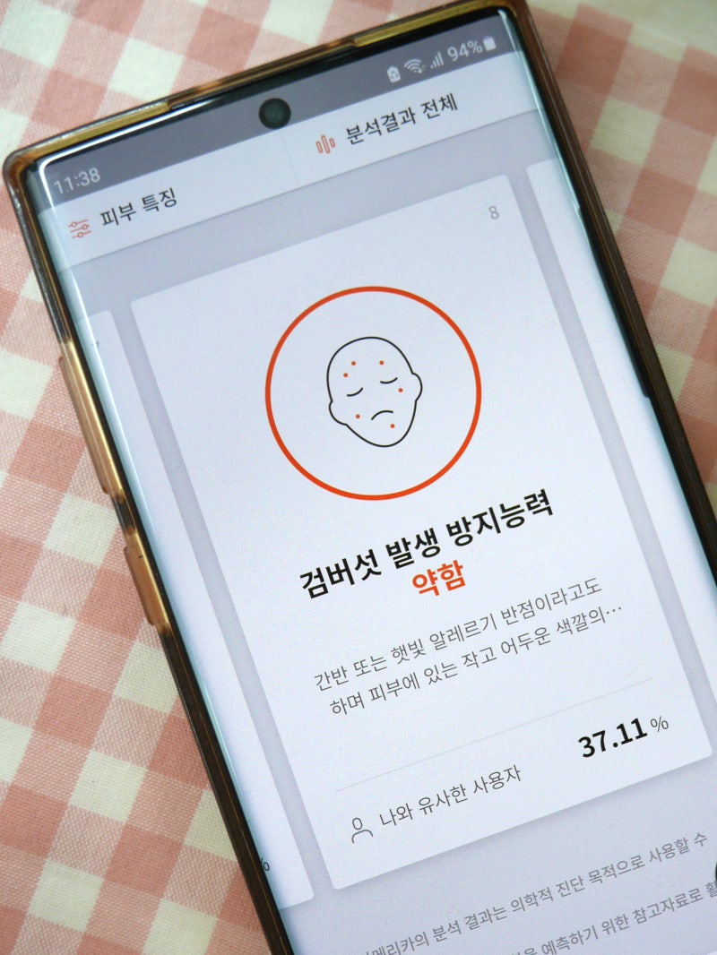 피부과 기미 치료 후 멜라닌 색소 케어 멜라토닝 크림 11