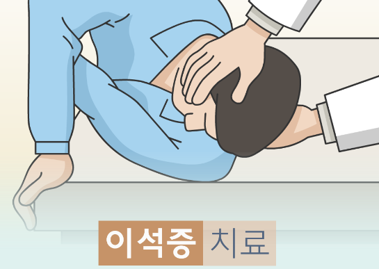  어지럼증 (2) - 이석증 (양성 돌발성 두위 현훈, Benign Paroxysmal Positional Vertigo, BPPV)의 치료(treatment)