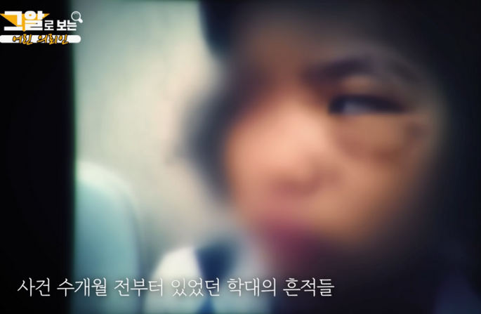 칠곡계모사건 8살 소원이 새엄마 임말자 칠곡계모사건 8살 소원이 새엄마 임말자