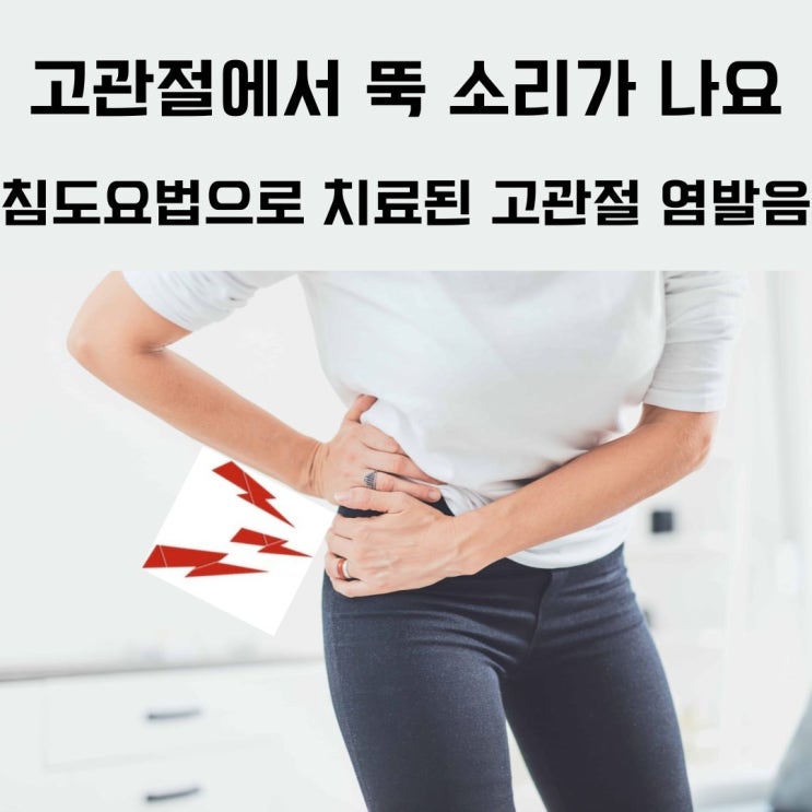  침도요법으로 치료된 고관절염발음(고관절에서 뚝 소리가 나요. 고관절소리의 원인과 치료)